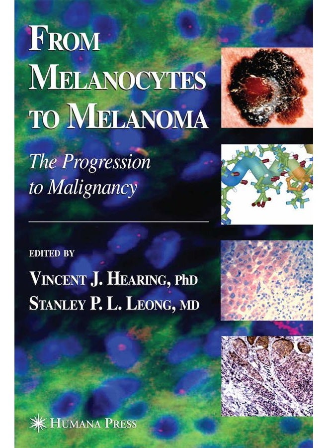 Press From Melanocytes to Melanoma: The Progression to Malignancy