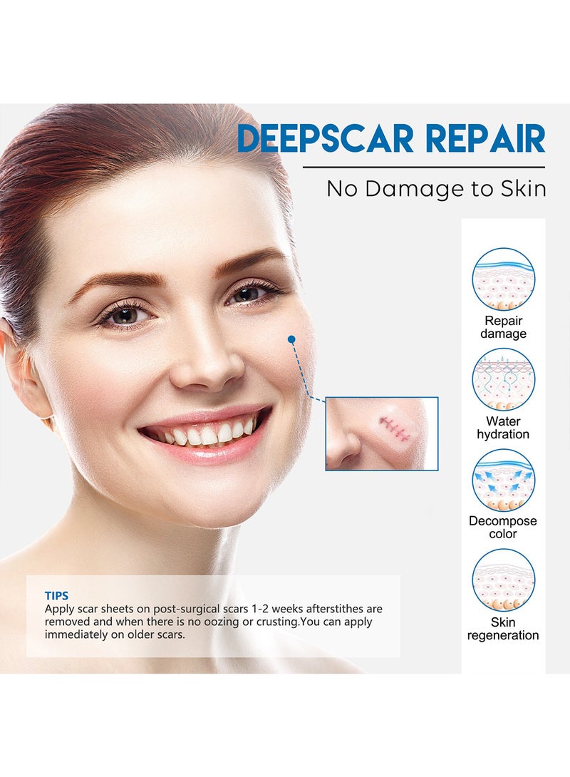 Elaimei Clear Silicone Scar Sheets, Fade Scar Sticker, Scar Removal Patch for Face & Body W2.5cm*L1.5m  - Image 5