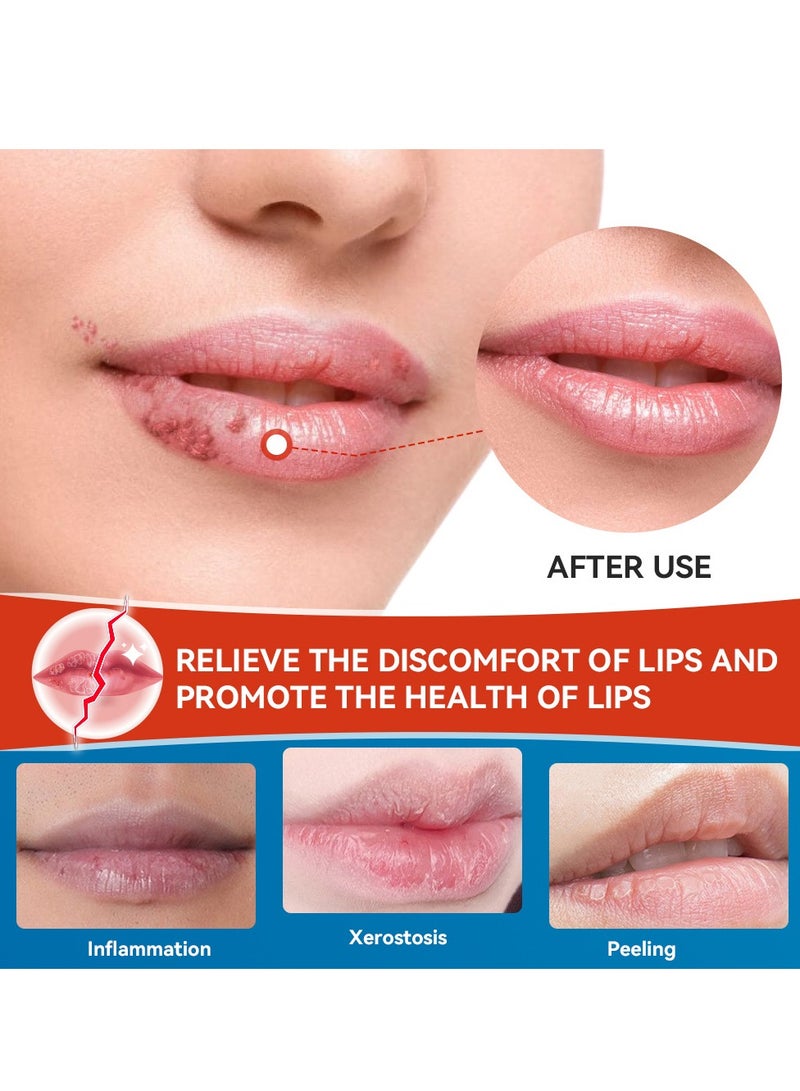 Sumifun Cheilitis Cream Lip Care Skin External Cream (20g) - Image 2