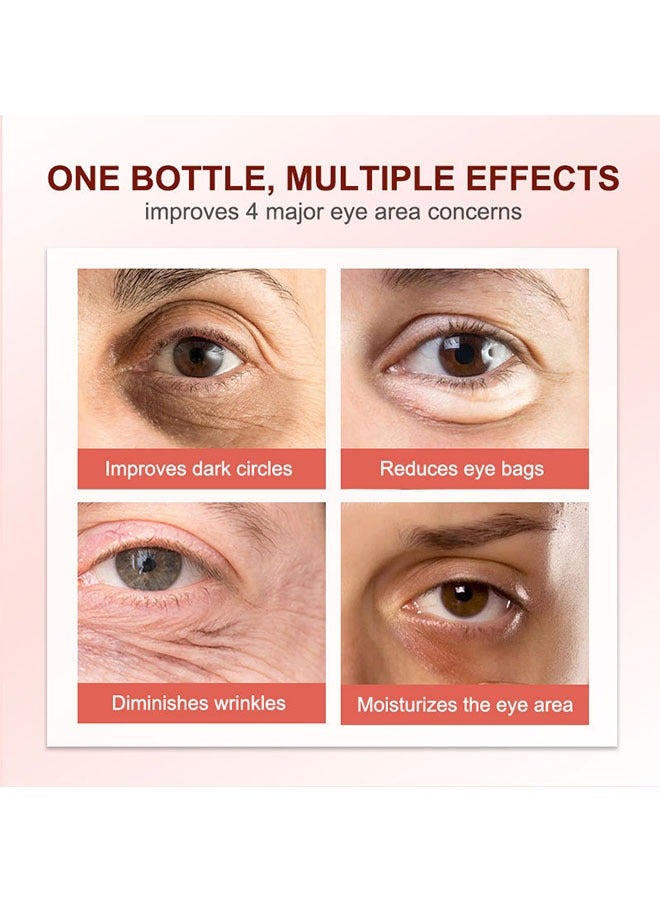 AuQuest Anti Dark Circles And Eye Bags Cream 20g, Fade Dark Circles, Remove Fine Lines and Eye Bags, Anti-Wrinkle Anti-Aging Firming Brighten Skin Cream, Eye Care Cream - Image 4