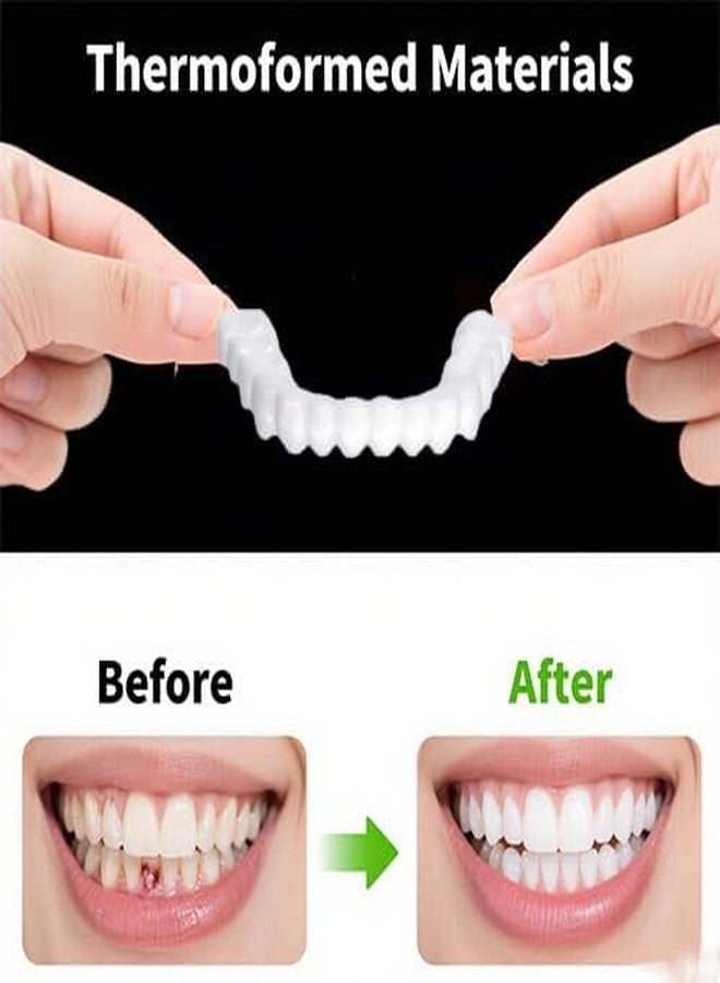 2 Pairs Food-Grade Safe Smile Fit, Tasteless Non-Irritating Material, Flexible Hand-Moldable Design for Daily Short-Term Social Wearing(1) - Image 2