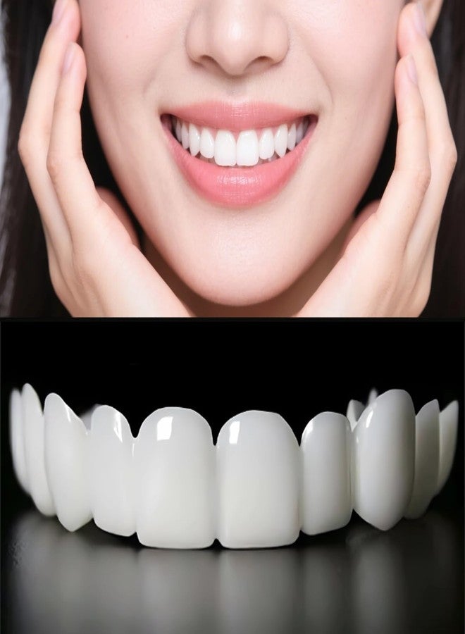 2 Pairs Food-Grade Safe Smile Fit, Tasteless Non-Irritating Material, Flexible Hand-Moldable Design for Daily Short-Term Social Wearing(1) - Image 1