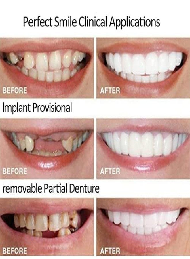 2 Pairs Food-Grade Safe Smile Fit, Tasteless Non-Irritating Material, Flexible Hand-Moldable Design for Daily Short-Term Social Wearing(1) - Image 4