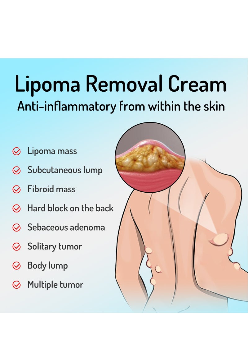 ساوث مون كريم العقدة الدهنية، يخفف الكتل الدهنية، والكتل تحت الجلد، ويفك كريم العناية بالجسم - Image 3