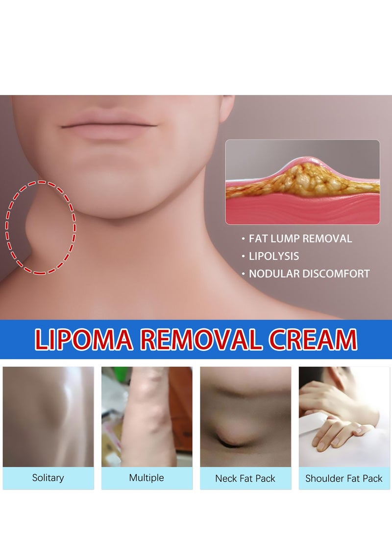 ساوث مون كريم العقدة الدهنية، يخفف الكتل الدهنية، والكتل تحت الجلد، ويفك كريم العناية بالجسم - Image 2