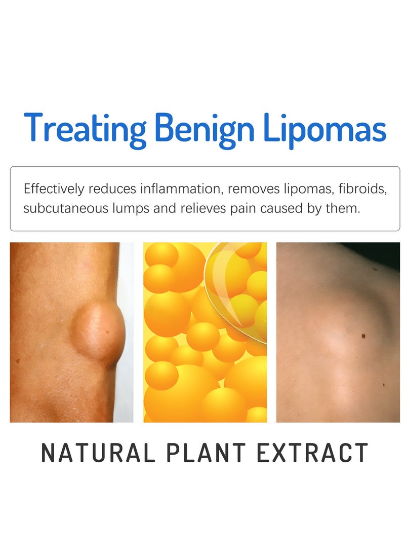 ساوث مون كريم العقدة الدهنية، يخفف الكتل الدهنية، والكتل تحت الجلد، ويفك كريم العناية بالجسم - Image 5