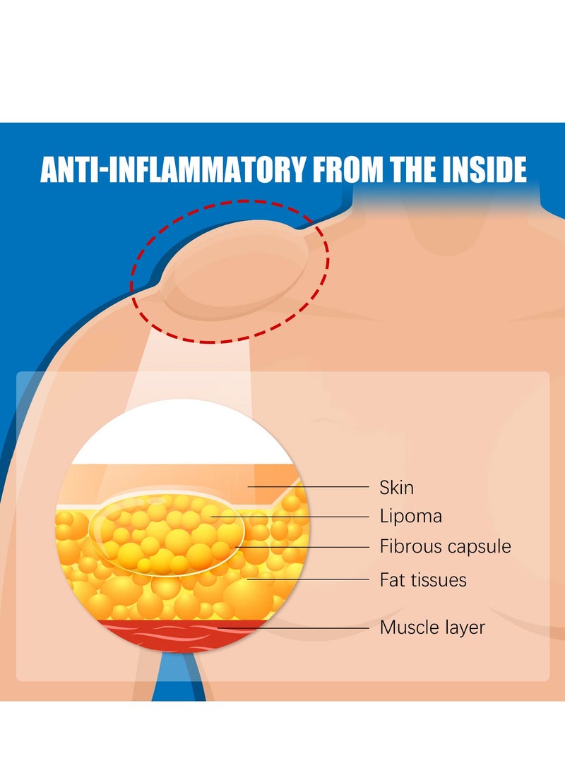 ساوث مون كريم العقدة الدهنية، يخفف الكتل الدهنية، والكتل تحت الجلد، ويفك كريم العناية بالجسم - Image 4
