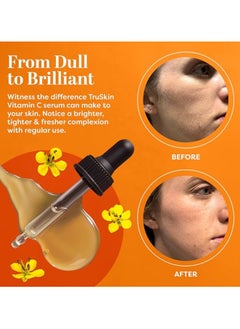 TruSkin TruSkin Vitamin  Serum for Face, Anti Aging Serum with Hyaluronic Acid, Vitamin E, Organic Aloe Vera and Jojoba Oil, Hydrating & Brightening Serum for Dark Spots, Fine Lines and Wrinkles,  - Image 4