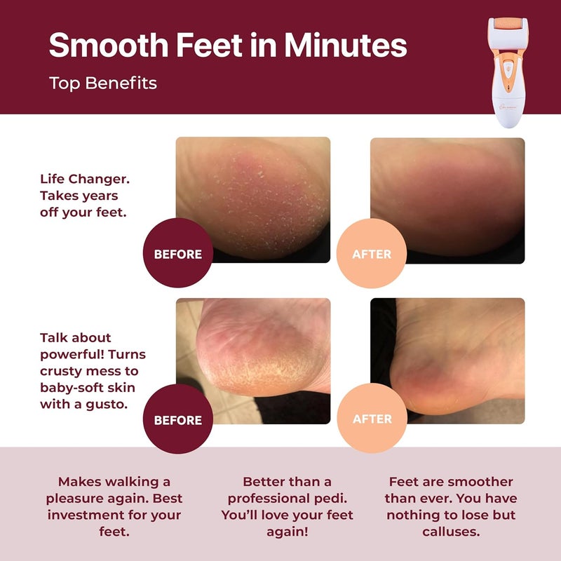 Own Harmony Professional Electric Foot Scrubber for Women: Callus Remover for Feet Care - Electronic Foot File Sander CR900 with 3 Rollers, Foot Grinder for Cracked Heels & Hard Skin (USB Cable) - Image 2