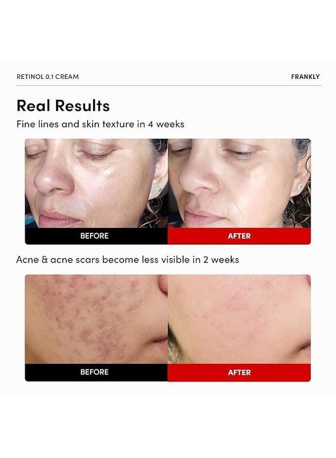 FRANKLY Retinol 0.1% Cream, 1.01 fl oz - Beginner Retinol | Night Cream | with Ceramides & Natural Ginseng | Anti-aging, Wrinkles Care, Reduces Congestion and hyperpigmentation | Korean Skin Care - Image 2
