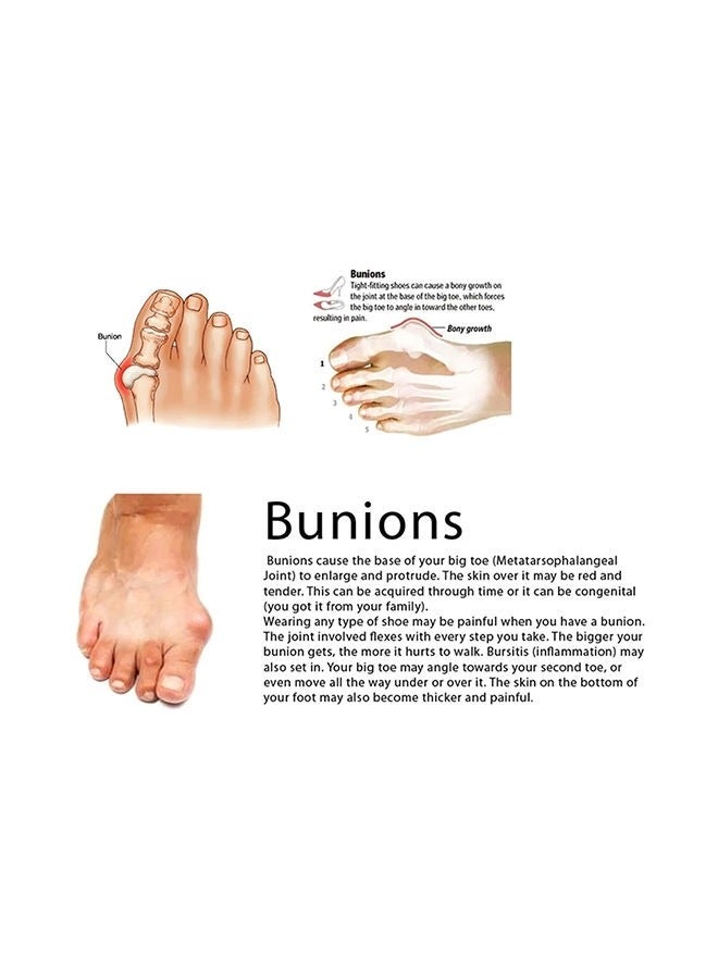 1 Pair Silicone Toe Separators Straightener Bunion Corrector - Image 3