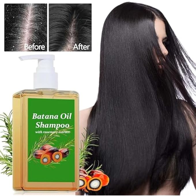 OVELLE شامبو زيت الباتانا، شامبو الباتانا للشعر، شامبو نمو الشعر العضوي مع زيت إكليل الجبل، زيت الخروع وزيت الباتانا، شعر رطب، شعر ناعم (1 قطعة) - Image 3