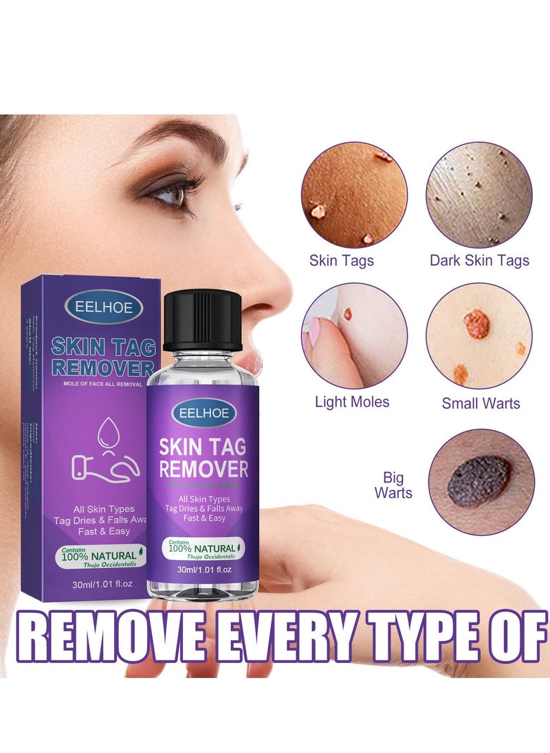 EELHOE mole of face all remova 30ml - Image 1