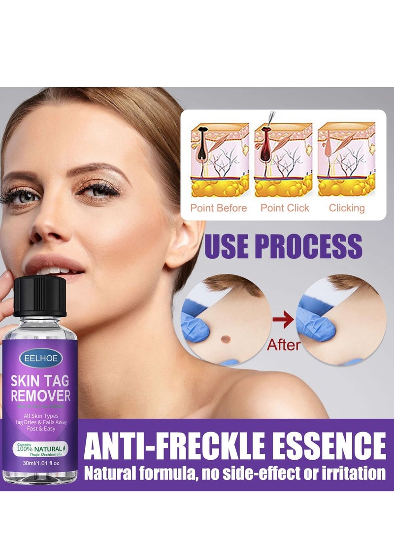 EELHOE mole of face all remova 30ml - Image 3