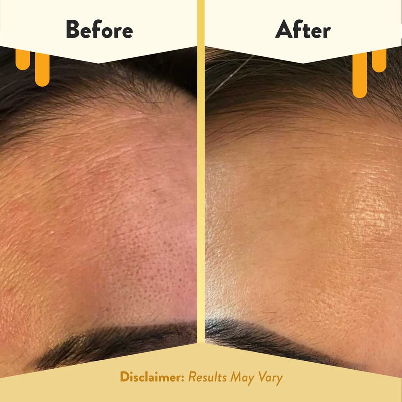 ECZEMA HONEY 15% Vitamin C + Ferulic Acid Serum - Anti Aging Skin Care Products - Face Oil for Eczema, Dry & Sensitive Skin (1 Oz) - Image 4