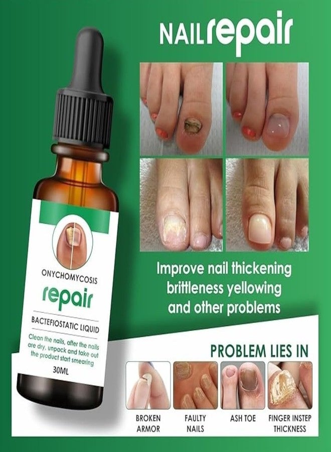 VIVAGLO Professional Nail Repair Serum - 100% Natural, Anti-Infective, Fungal Infection Removal, 30ML - Image 2