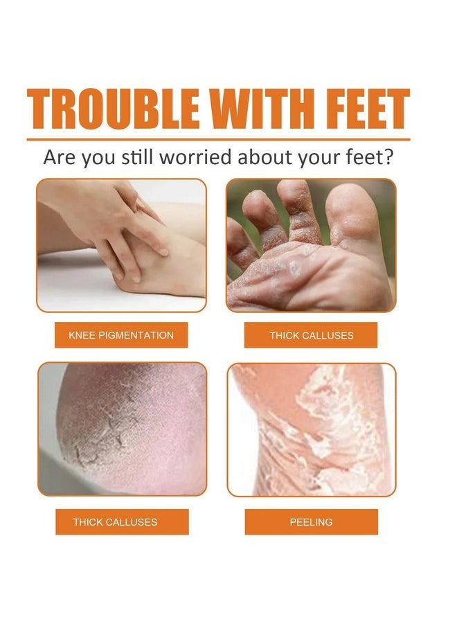 Rosarden - Foot Callus Removal Spray, Foot Peeling Spray, Foot Spray For Dry Cracked Feet, Foot Exfoliating Spray Remove Dead Skin From Feet, Foot Softener Hydrating Nourish, Improve Rough Heels - Image 1