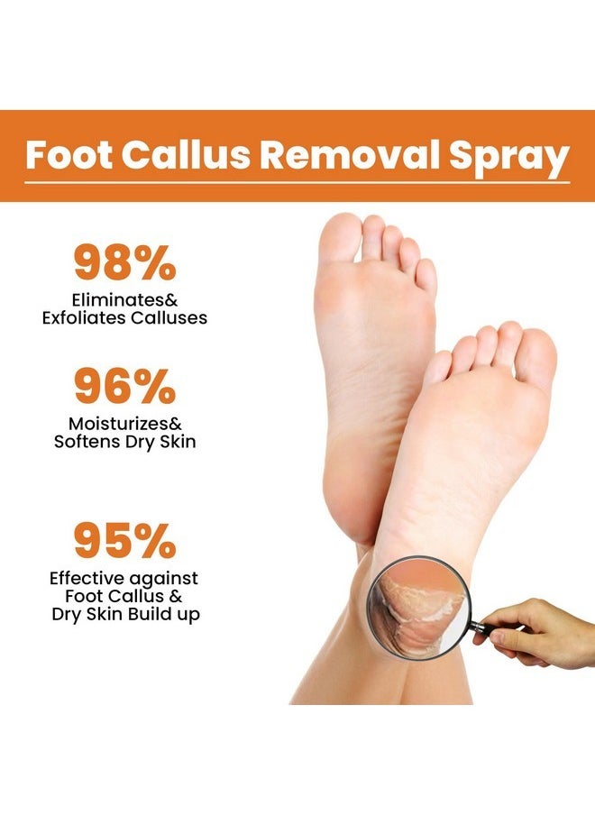 Rosarden - Foot Callus Removal Spray, Foot Peeling Spray, Foot Spray For Dry Cracked Feet, Foot Exfoliating Spray Remove Dead Skin From Feet, Foot Softener Hydrating Nourish, Improve Rough Heels - Image 1