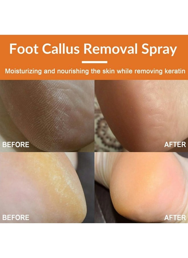 Rosarden - Foot Callus Removal Spray, Foot Peeling Spray, Foot Spray For Dry Cracked Feet, Foot Exfoliating Spray Remove Dead Skin From Feet, Foot Softener Hydrating Nourish, Improve Rough Heels - Image 1