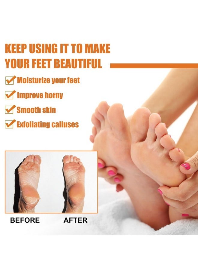 Rosarden - Foot Callus Removal Spray, Foot Peeling Spray, Foot Spray For Dry Cracked Feet, Foot Exfoliating Spray Remove Dead Skin From Feet, Foot Softener Hydrating Nourish, Improve Rough Heels - Image 1