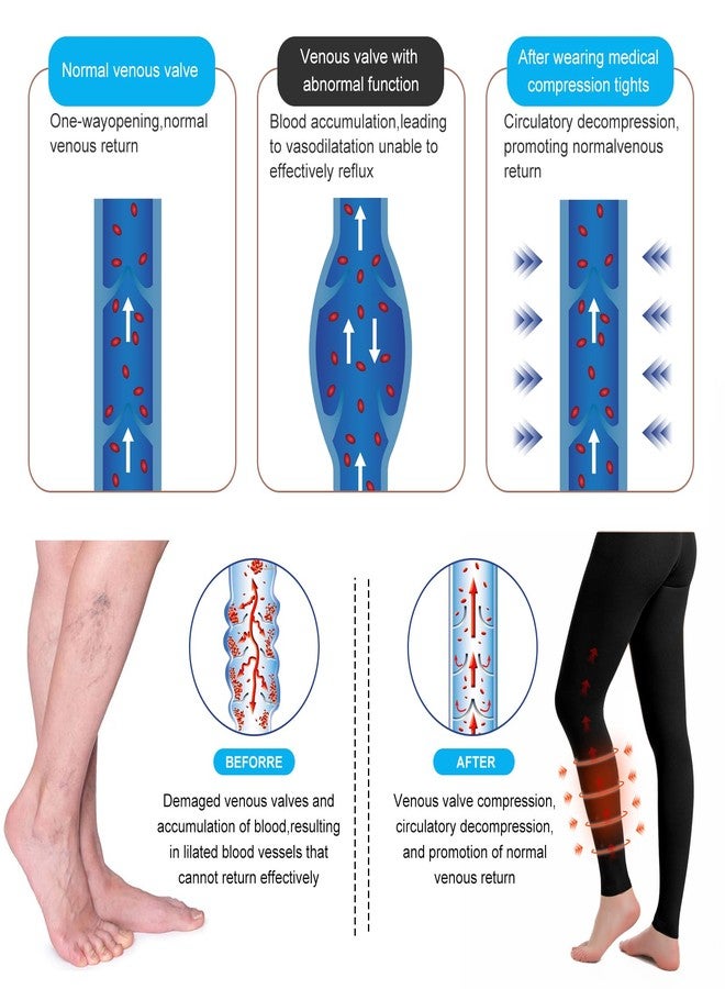 YISEMEYA Medical Compression Pantyhose for Women & Men, 20-30mmHg Graduated Support Tights, Opaque Footless High Waist Tights, Graduated Tights for Varicose Veins, Edema, Deep, Thrombosis , During (Black, M) - Image 3