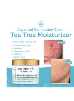 Era Organics Era Organics Tea Tree Cream Face Moisturizer for Oily Skin - Advanced 7X Balancing Oily Skin Moisturizer - Non-Greasy Moisturizer - Tea Tree Oil for Skin  - Image 4