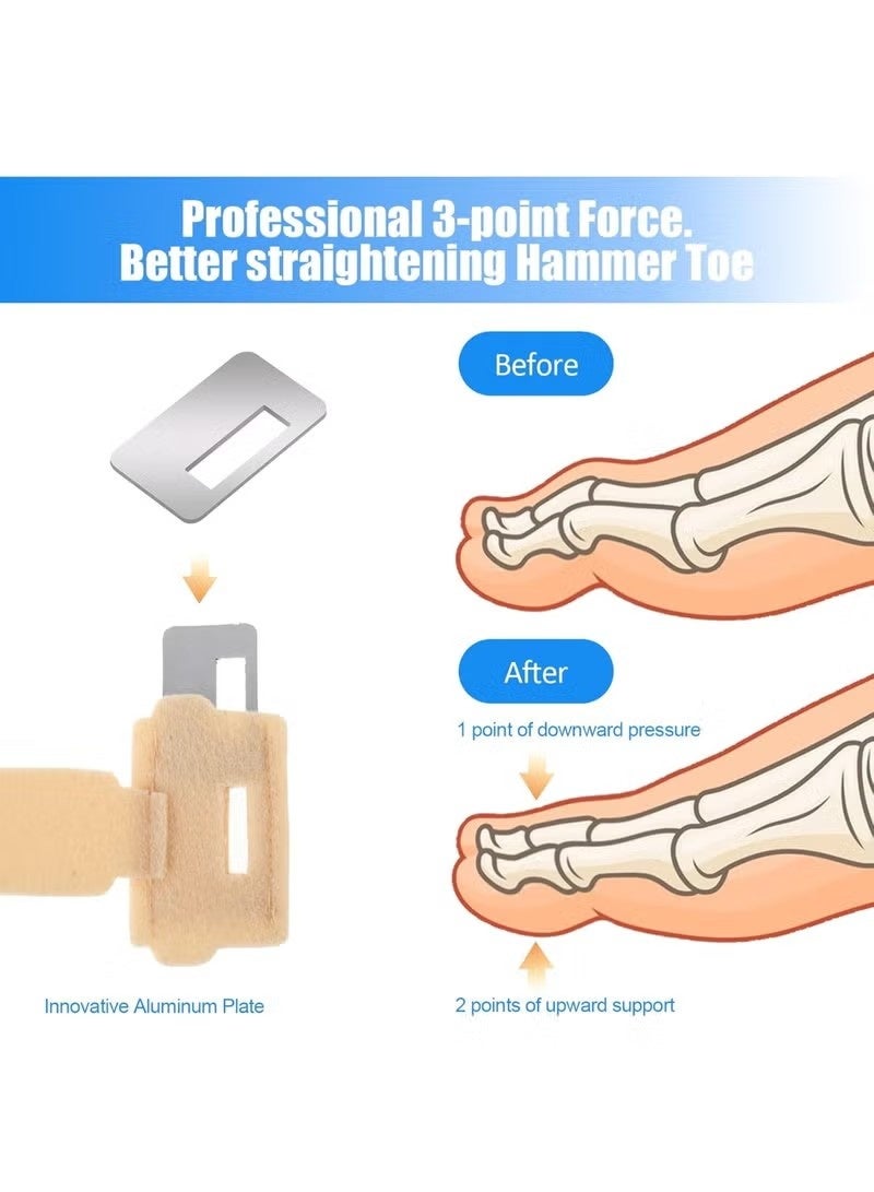 4 قطع من مصحح تقويم أصابع القدم المطرقية، ضمادات ودعامات لتخفيف آلام أصابع القدم الملتوية والمتعرجة والمكسورة. - Image 3