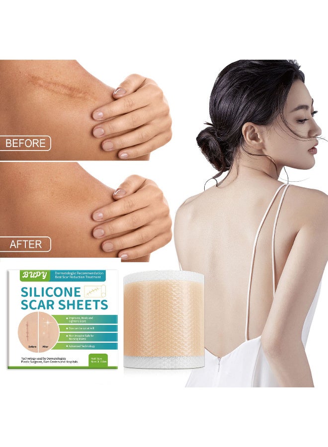 بوبي قطعتان من ملصقات الندبات السيليكونية، ملصق ندبة باهتة، 4 سم × 3 م، إزالة ندبات التجميل بكفاءة، شريط لاصق ذاتي لإصلاح حروق حب الشباب، جل سيليكون ناعم - Image 4