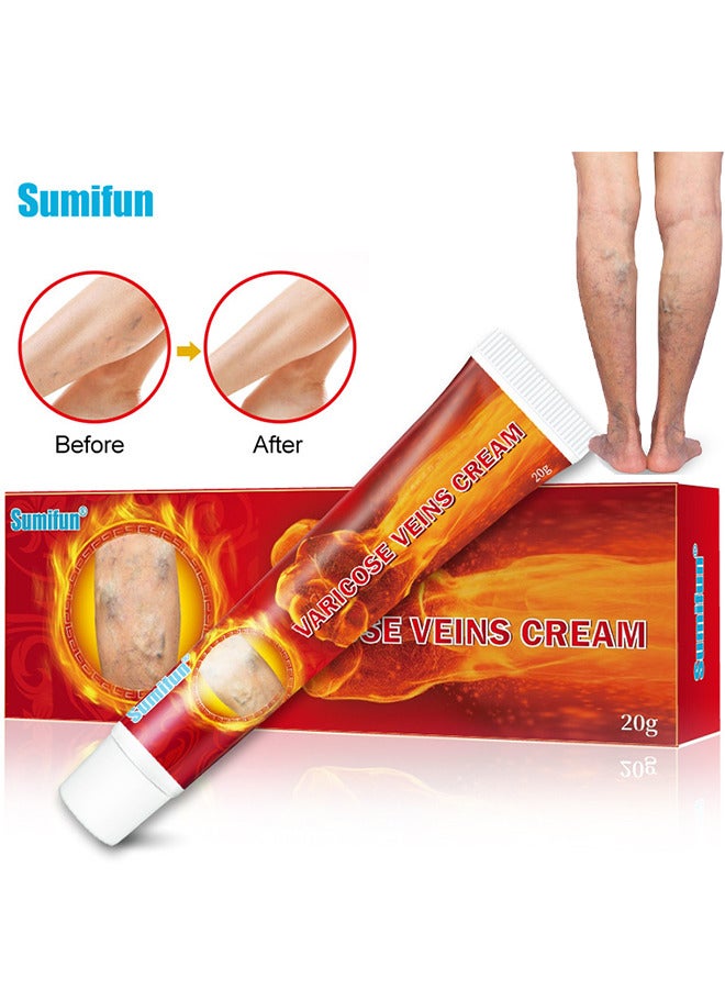 Sumifun Varicose Veins Cream 20G, Phlebitis Spider Pain Relief Balm, Relieve Swelling And Pain, Improve Blood Circulation, Venous Health Ointment, Soothes Tired Legs  - Image 1