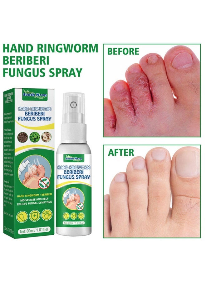 SOUTH MOON Hand Foot Care Medicine Gentle Formula Antifungal Spray South Moon Hand Ringworm Beriberi Fungus Spray 30ml - Image 3