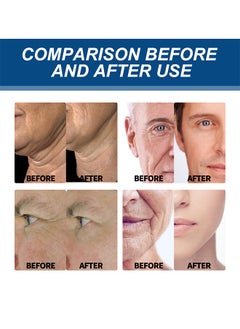 East Moon Men's Age Revive Collagen Facial Cream, Fade Fine Lines, Tighten Skin, Age Rewind Wrinkles Smoothing Gel, Day And Night Skin Care Moisturizing And Tightening Lotion, 30g  - Image 5