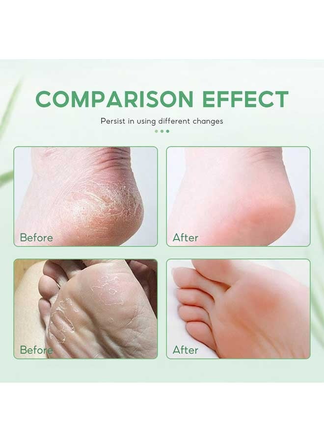 سوماكس كريم النعناع للعناية بالقدمين 30ml ، مرطب خفيف خال من تهيج البشرة بالقدمين ، مطهر لإزالة الطبقة القرنية ، كريم مرطب للقدمين للبشرة الخشنة / السميكة / الجافة / متصدع - Image 4