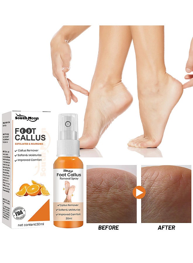 SOUTH MOON Anti Foot Callus Removal Spray - Foot Callus Removal Spray - Instant Foot Peeling Spray - Foot Peeling Spray Oil - Foot Peeling Spray For Remove Dead Skin - Image 1