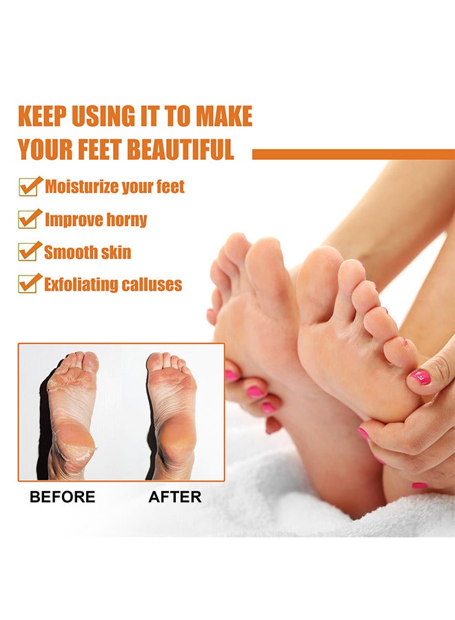 SOUTH MOON Anti Foot Callus Removal Spray - Foot Callus Removal Spray - Instant Foot Peeling Spray - Foot Peeling Spray Oil - Foot Peeling Spray For Remove Dead Skin - Image 4