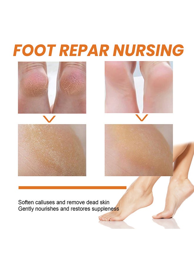 SOUTH MOON Anti Foot Callus Removal Spray - Foot Callus Removal Spray - Instant Foot Peeling Spray - Foot Peeling Spray Oil - Foot Peeling Spray For Remove Dead Skin - Image 5