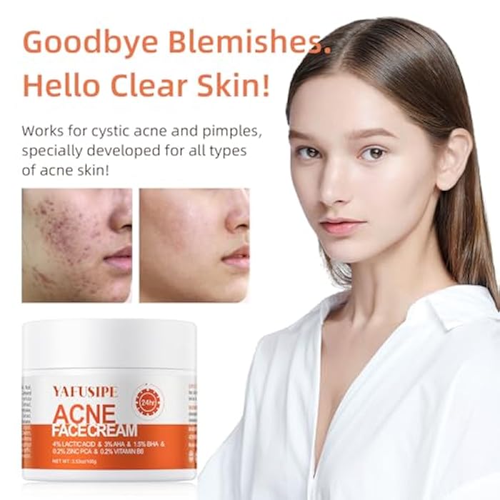 YAFUSIPE Acne Treatment for Face for Hormonal Cystic Stubborn Acne Cream for Sensitive Skin Teens Adults Women Men Spot Pimple Butt Control Rapid Clearing Breakout Overnight Face Blemish Treatment - Image 3