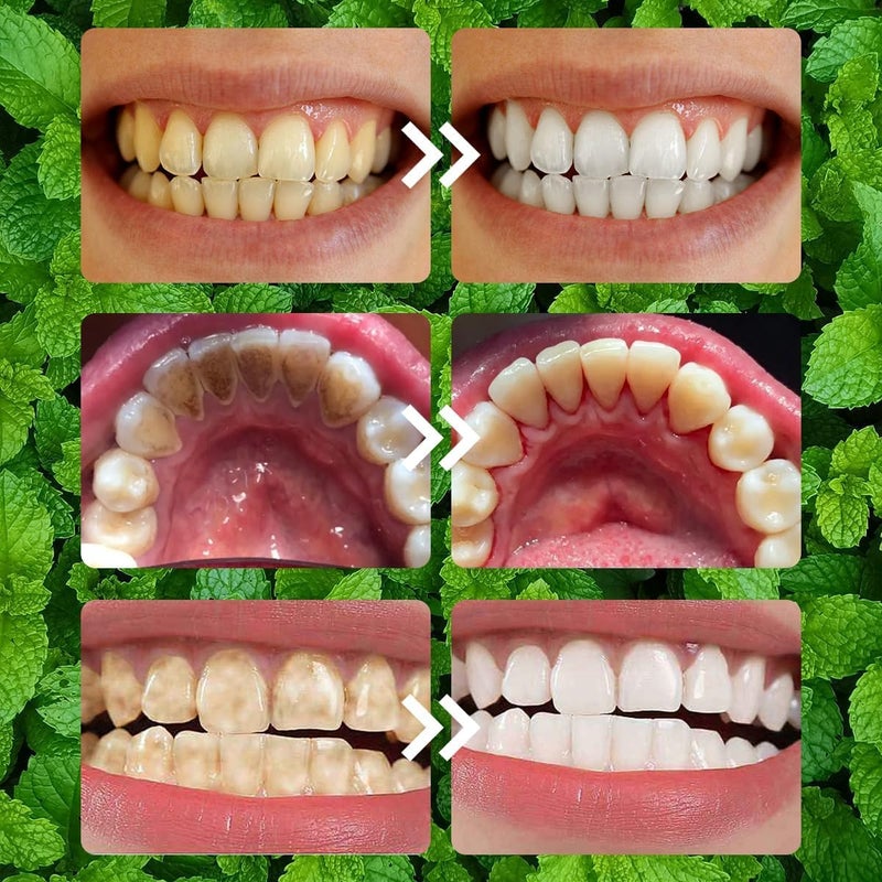 Oprtuisi 2PCS Purple Teeth Restoration Mineral Powder, Mineral Tooth Powder, Dental Restoration Mineral Effective in Strengthening Teeth and Gums for Daily Use - Image 4