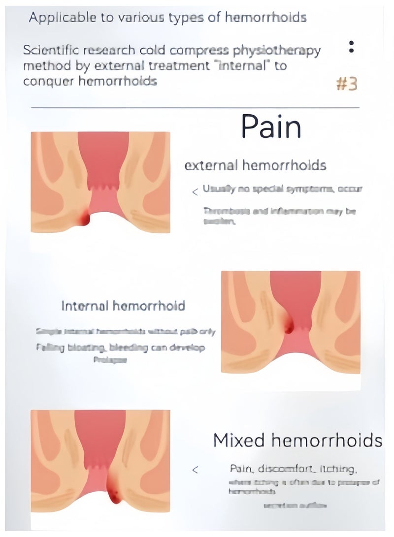 APDMP APGAR Hemorrhoid Relief Ointment: Rapidly relieves hemorrhoids and anal fissures - Image 4