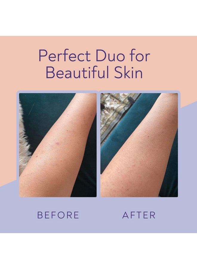 VIGORITY KP Bump Eraser Body Scrub & Keratosis Pilaris Lotion Bundle Set - Strawberry Legs Treatment for Women - Exfoliates & Deeply Hydrates for Smoother Healthy-Looking Skin - Image 2