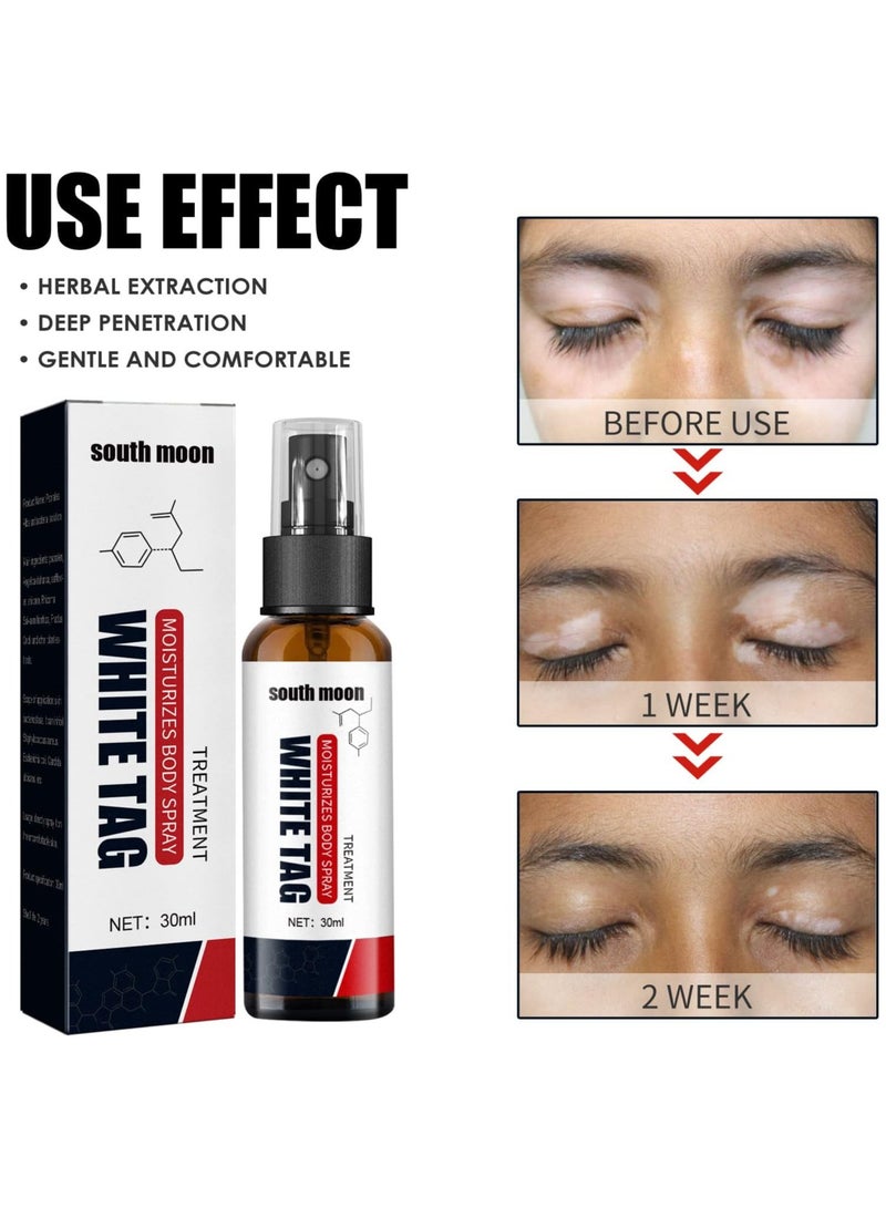 SOUTH MOON بخاخ ديرماكس لعلاج الصدفية - 30 مل بخاخ صدفية، مهدئ ومرطب كريم صدفية القطران، بخاخ للعناية بالبشرة لفيتليغو - Image 2