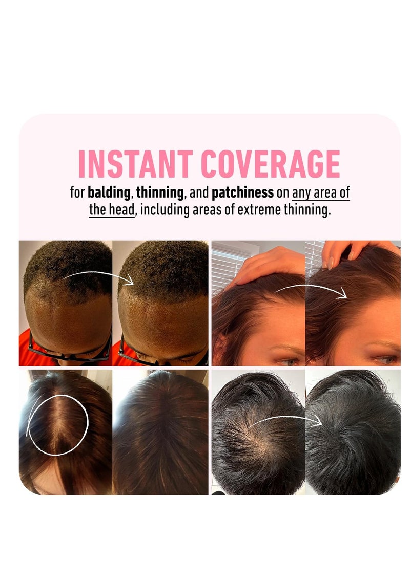 Boldify BOLDIFY Hairline Powder - Root Touch Up & Hair Loss Cover Up, Instant Gray Coverage 48-Hour Stain-Proof Hair Color Powder for Women & Men, Hair Fibers and Hair Topper Alternative (Dark Brown)  - Image 4