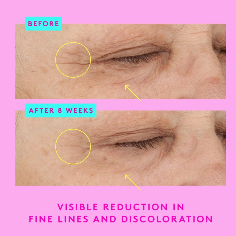 Drunk Elephant A-Shaba Complex Eye Serum - 15 ml/.5 fl oz - .1% Retinol Eye Cream - Clean Clinical Skincare - Cruelty-Free - Dermatologist-Tested - Free of Essential Oils, Silicones, and Fragrance - Image 4