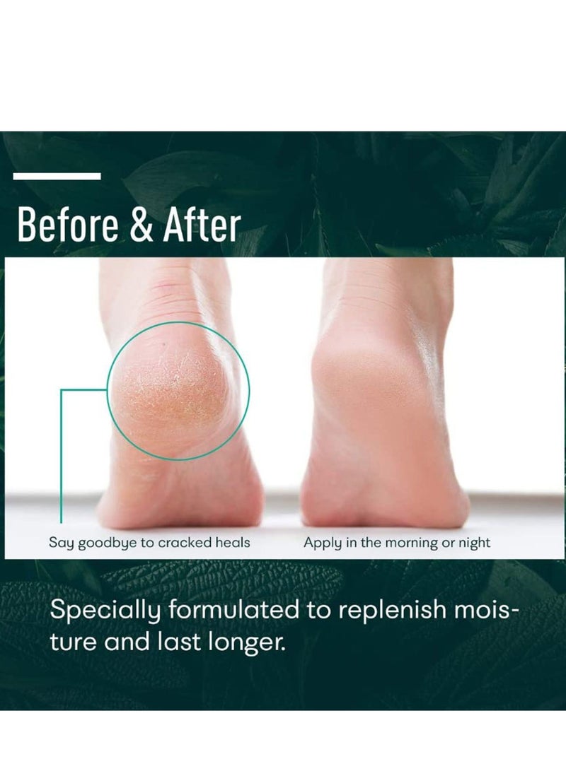 LANEMAY Urea Cream 40 Percent for Feet Maximum Strength with 2% Salicylic Acid, Callus Remover, Dead Skin Exfoliation, Hand and Foot Cream for Dry Cracked Hands,Elbows, Feet, Heels, Knees - Image 3