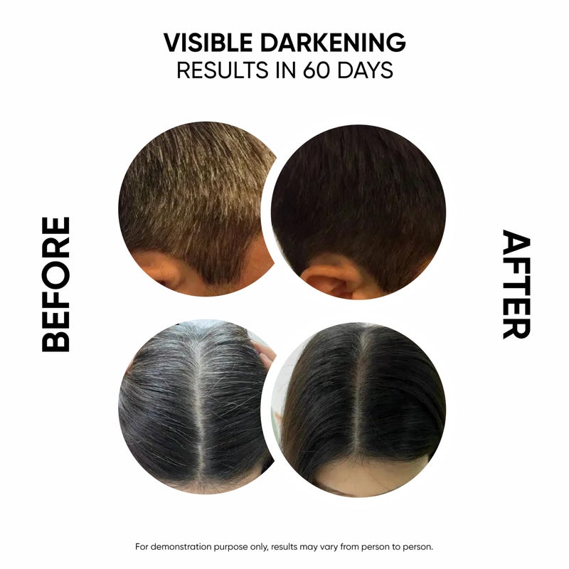 Masofta Anti Gray Hair Darkening Serum | Reverses & Limits Hair & Beard Greying | Promotes Shinier Hair | With Arcolys, Melano Gray, Biotin & Bhringraj For Both Men & Women, 50ML - Image 3