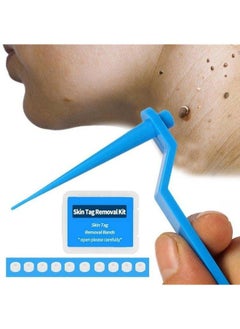 Micro Band Non Toxic Face Care Mole Wart Tool For Small To Medium Blue Skin Tag Removal Kit With Cleansing Swabs Home Use Adult - pzsku/Z39C83D63282C81B9FE33Z/45/_/1690021791/c7fcfb95-9d64-4159-8986-35912b95d17e