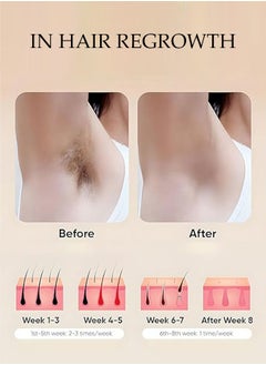 Generic Laser Hair Removal, Hair Removal Device with Scraper, Laser Hair Removal Device with Sunglasses, Laser Hair Removal for Women, IPL Laser Hair Removal for Armpits, Legs, Arms, Gini Line Facial  - Image 5