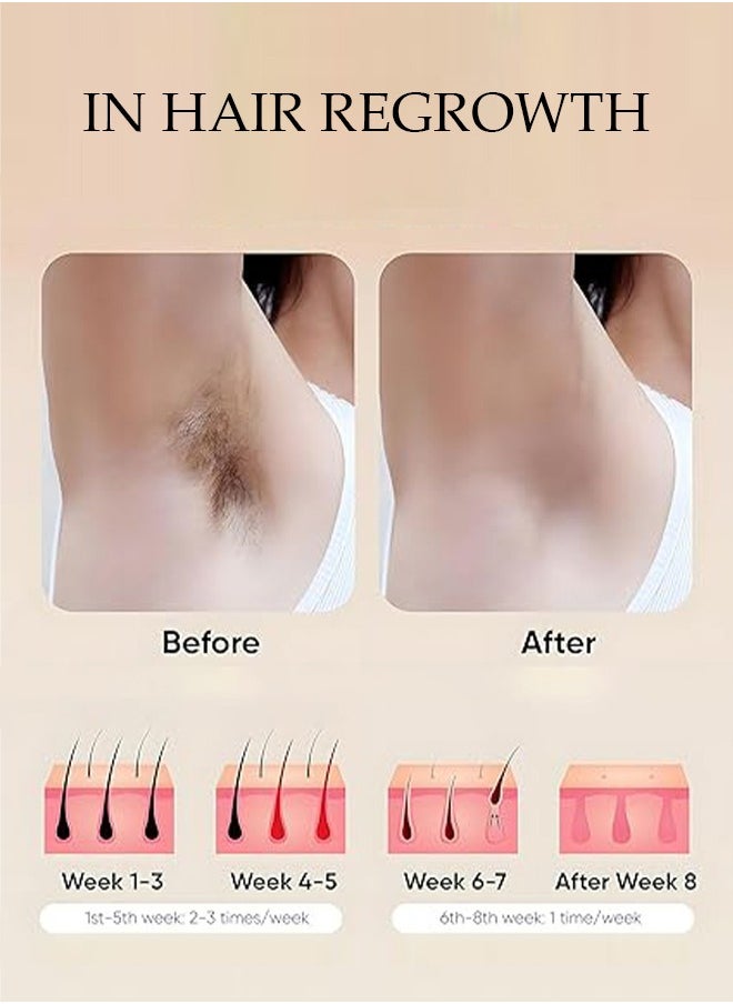 Generic إزالة الشعر بالليزر، جهاز إزالة الشعر مع مكشطة، جهاز إزالة الشعر بالليزر مع نظارة شمسية، إزالة الشعر بالليزر للنساء، إزالة الشعر بالليزر IPL للإبطين والساقين والذراعين، خط جيني للوجه  - Image 5