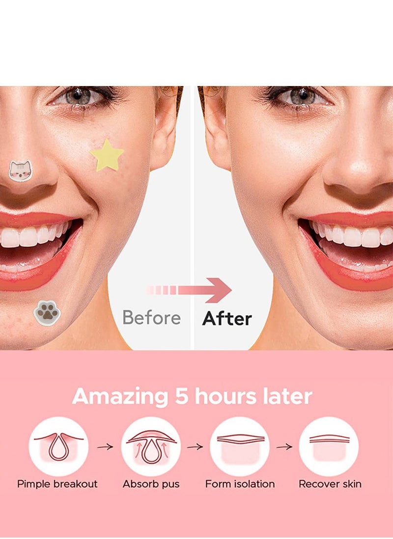 Kormesic - Pimple Patches for Face 64Pcs - Acne Pimple Patches with Hydrocolloid and Salicylic Acid - Star Pimple Patches for Covering Zits, Blemishes, Dark Spots - 36 Cute Shapes and Colors (#64, M) - Image 1