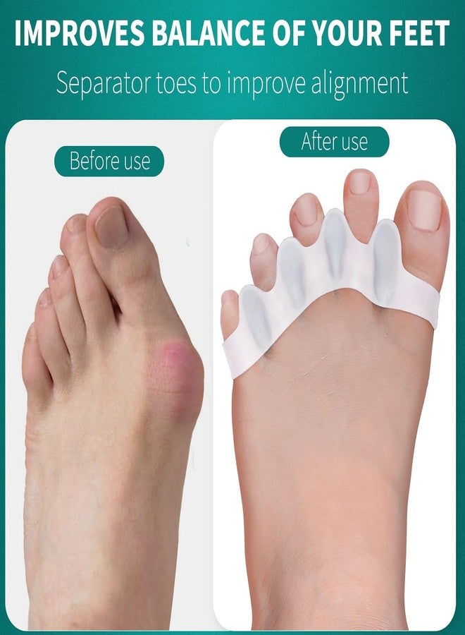 QIQVERT White Gel Toe Separator Silicone Pain Relief Toe Spacer for Men Bunion Corrector for Women Toe Straightener Hammer Hallux Valgus Corrector Foot Finger Separator Leg Finger Protector Support - Image 5