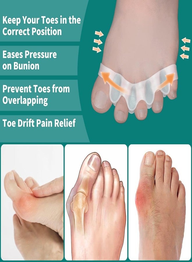 QIQVERT White Gel Toe Separator Silicone Pain Relief Toe Spacer for Men Bunion Corrector for Women Toe Straightener Hammer Hallux Valgus Corrector Foot Finger Separator Leg Finger Protector Support - Image 4